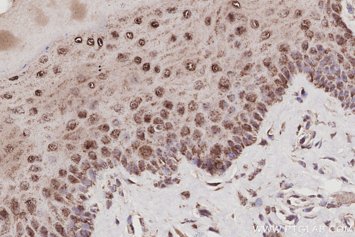Immunohistochemical analysis of paraffin-embedded rat tongue tissue slide using KHC3057 (POLDIP2 IHC Kit). Immunohistochemical analysis of paraffin-embedded rat tongue tissue slide using KHC3057 (POLDIP2 IHC Kit).