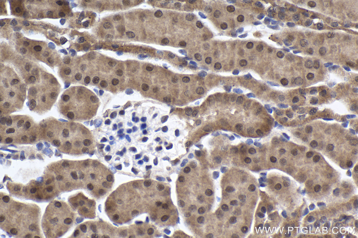 Immunohistochemical analysis of paraffin-embedded mouse kidney tissue slide using KHC1908 (POLDIP3/SKAR IHC Kit).