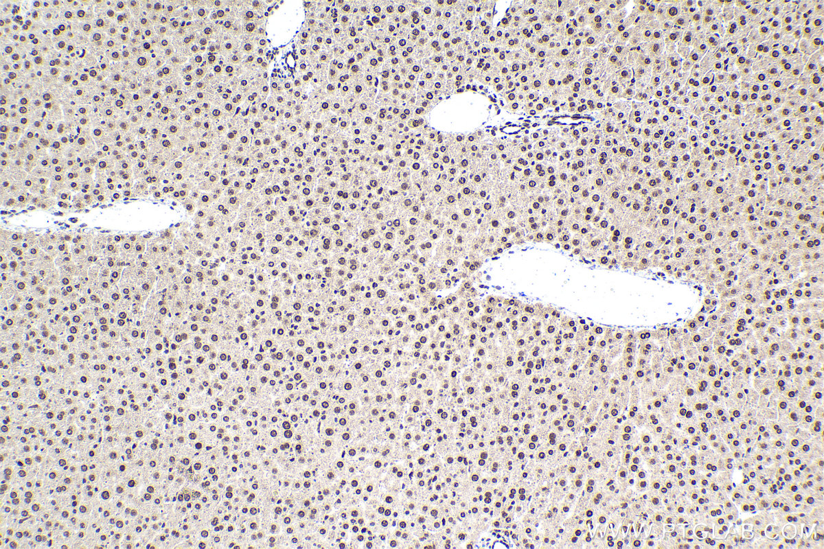 Immunohistochemical analysis of paraffin-embedded mouse liver tissue slide using KHC1577 (POLR2B IHC Kit).