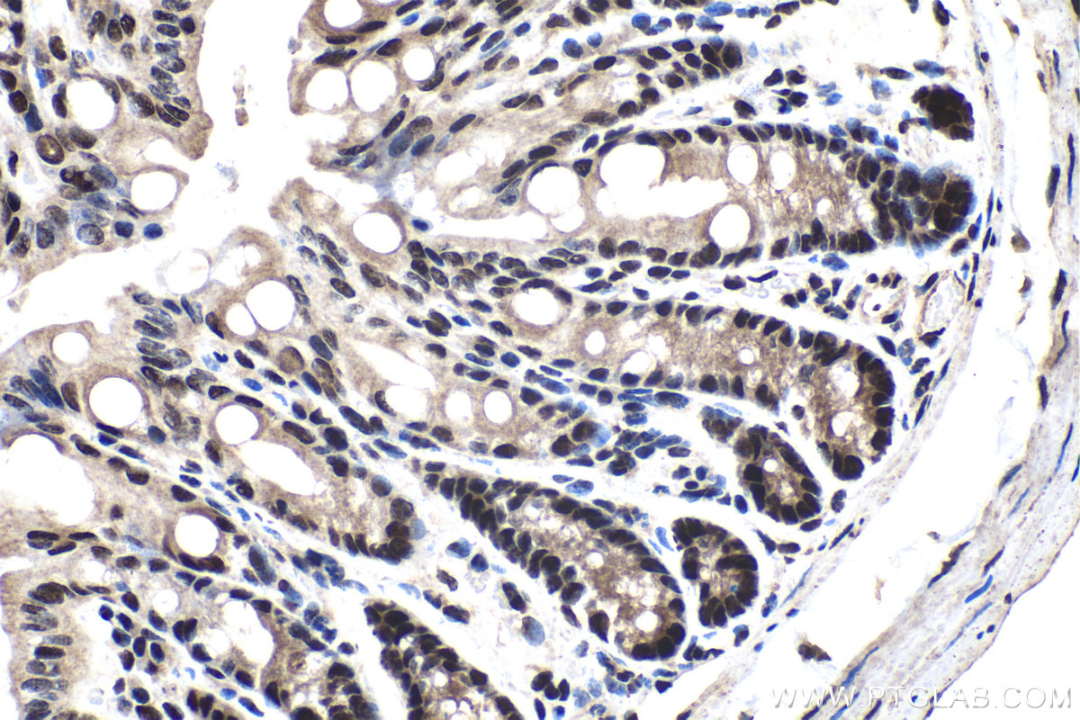 Immunohistochemical analysis of paraffin-embedded mouse colon tissue slide using KHC1544 (POLR2C IHC Kit).