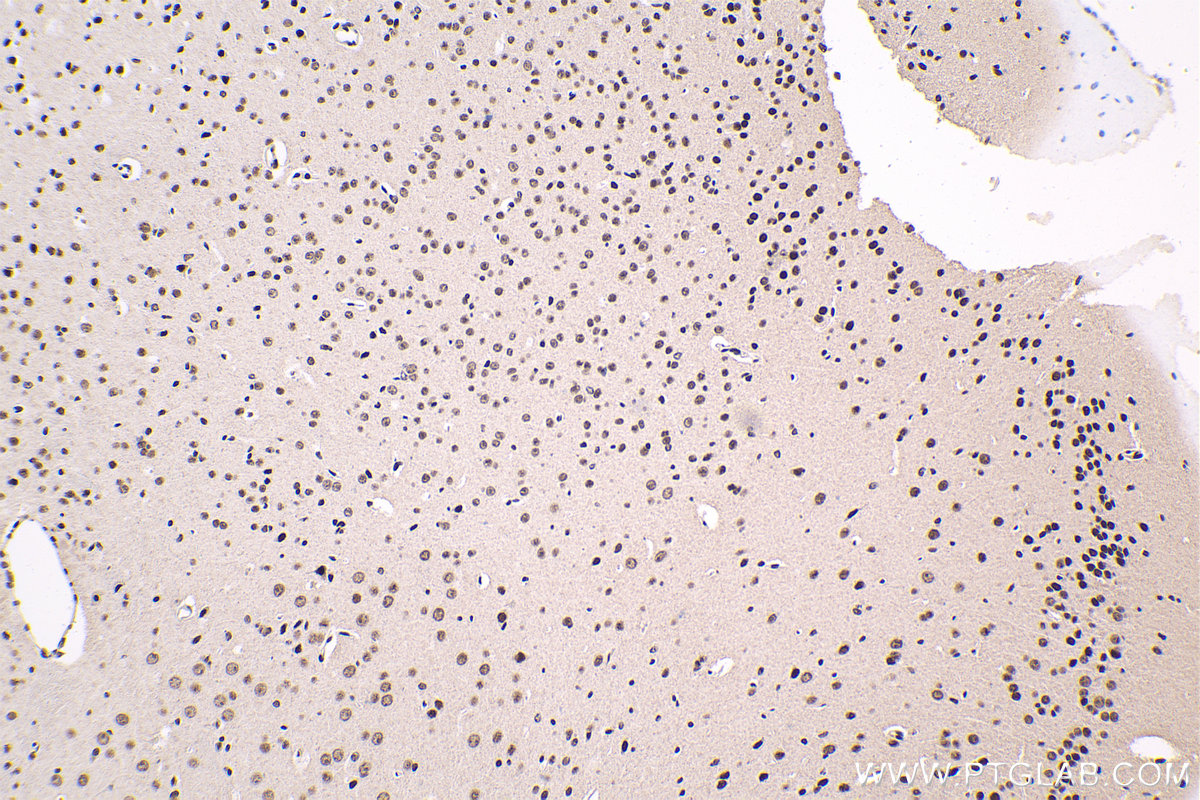 Immunohistochemical analysis of paraffin-embedded mouse brain tissue slide using KHC1640 (POLR2F IHC Kit).