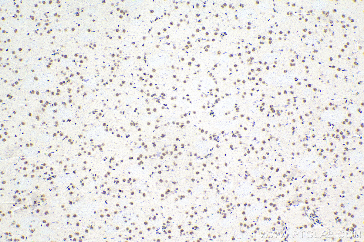 Immunohistochemical analysis of paraffin-embedded rat brain tissue slide using KHC1640 (POLR2F IHC Kit).