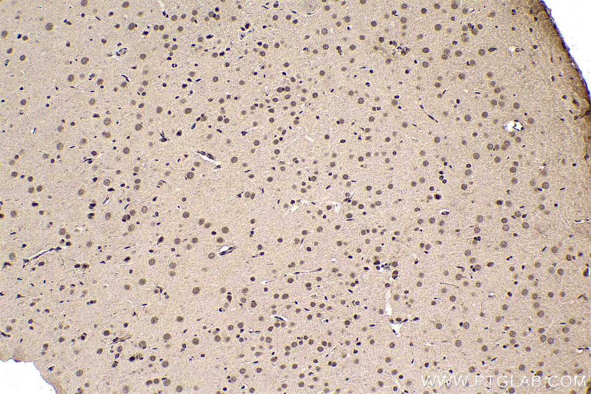 Immunohistochemical analysis of paraffin-embedded rat brain tissue slide using KHC1600 (POLR2I IHC Kit).