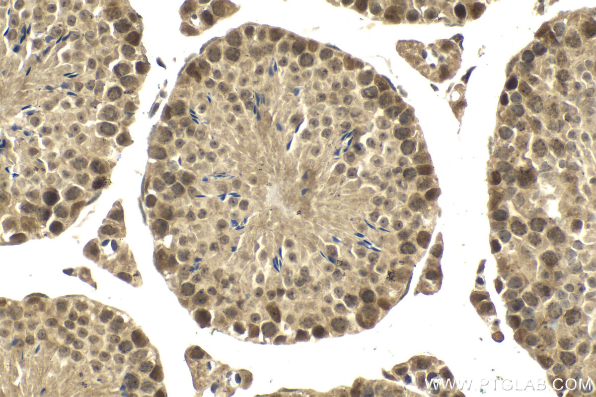 Immunohistochemical analysis of paraffin-embedded mouse testis tissue slide using KHC2071 (POLR3G IHC Kit).