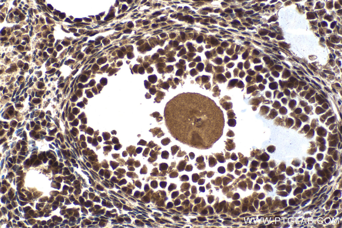 Immunohistochemical analysis of paraffin-embedded mouse ovary tissue slide using KHC2071 (POLR3G IHC Kit).