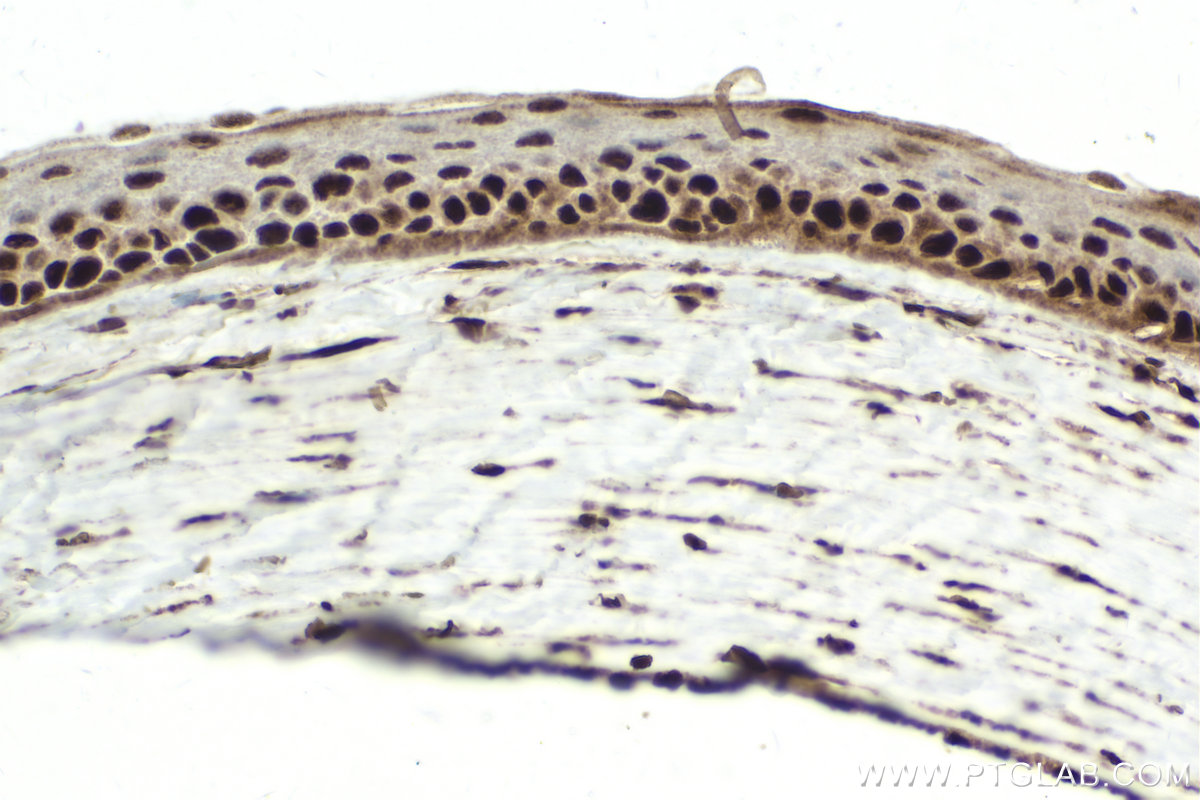 Immunohistochemical analysis of paraffin-embedded rat eye tissue slide using KHC1750 (POU4F3 IHC Kit).