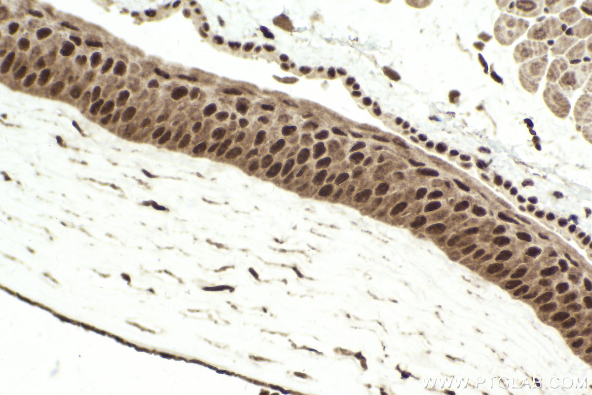 Immunohistochemical analysis of paraffin-embedded mouse eye tissue slide using KHC1750 (POU4F3 IHC Kit).