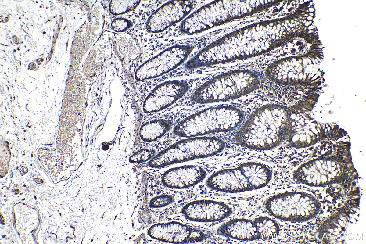 Immunohistochemical analysis of paraffin-embedded human colon tissue slide using KHC1193 (PPAN IHC Kit).