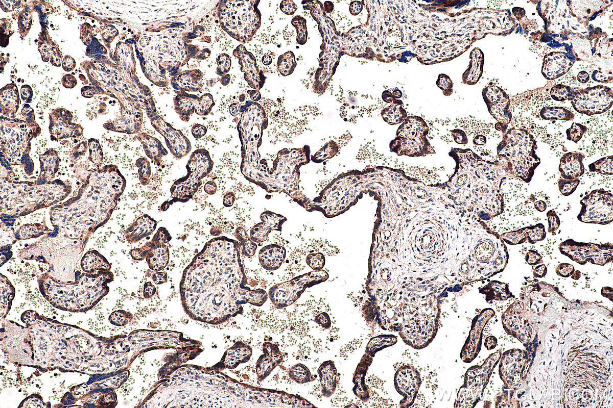 Immunohistochemical analysis of paraffin-embedded human placenta tissue slide using KHC0249 (PPARG IHC Kit).