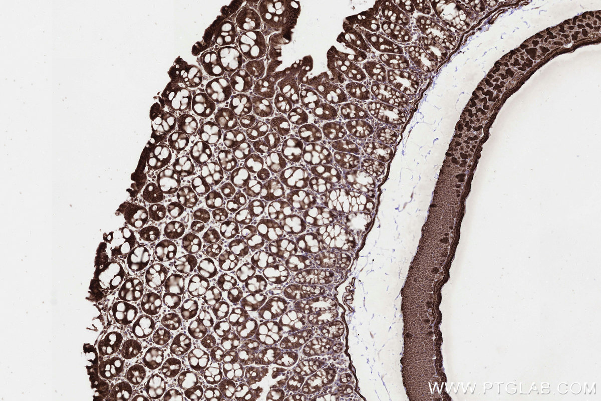Immunohistochemical analysis of paraffin-embedded mouse colon tissue slide using KHC3247 (PPAT IHC Kit). Immunohistochemical analysis of paraffin-embedded mouse colon tissue slide using KHC3247 (PPAT IHC Kit).