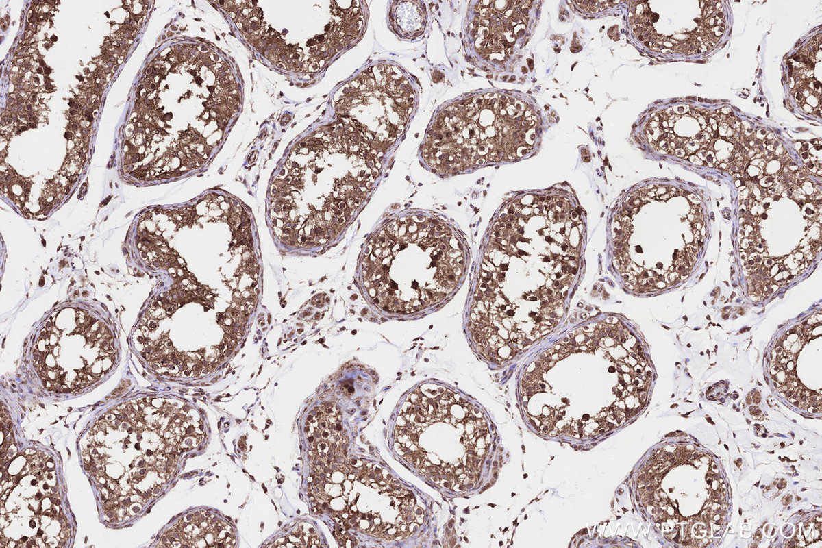 Immunohistochemical analysis of paraffin-embedded human testis tissue slide using KHC3247 (PPAT IHC Kit). Immunohistochemical analysis of paraffin-embedded human testis tissue slide using KHC3247 (PPAT IHC Kit).