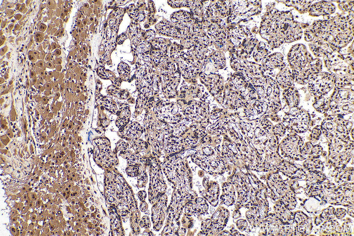 Immunohistochemical analysis of paraffin-embedded human placenta tissue slide using KHC0654 (PPIA IHC Kit).