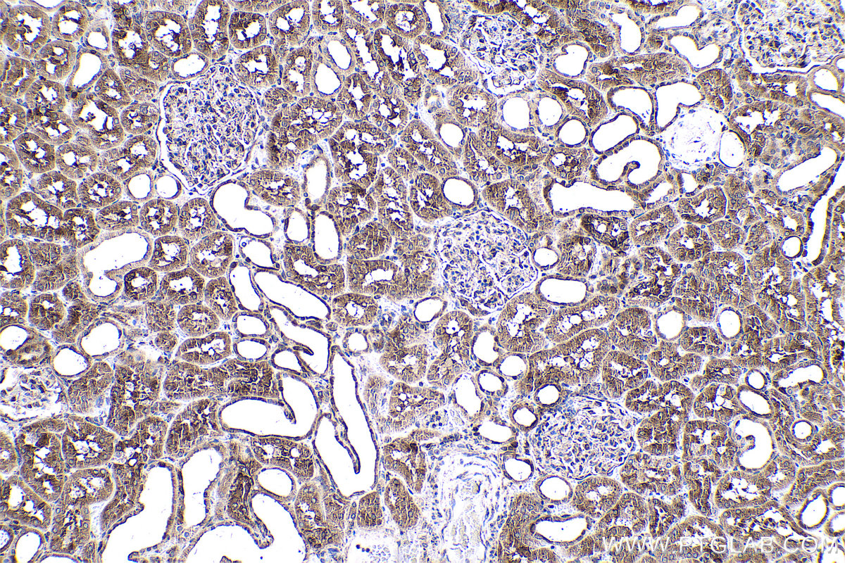 Immunohistochemical analysis of paraffin-embedded human kidney tissue slide using KHC0523 (PPIB IHC Kit).