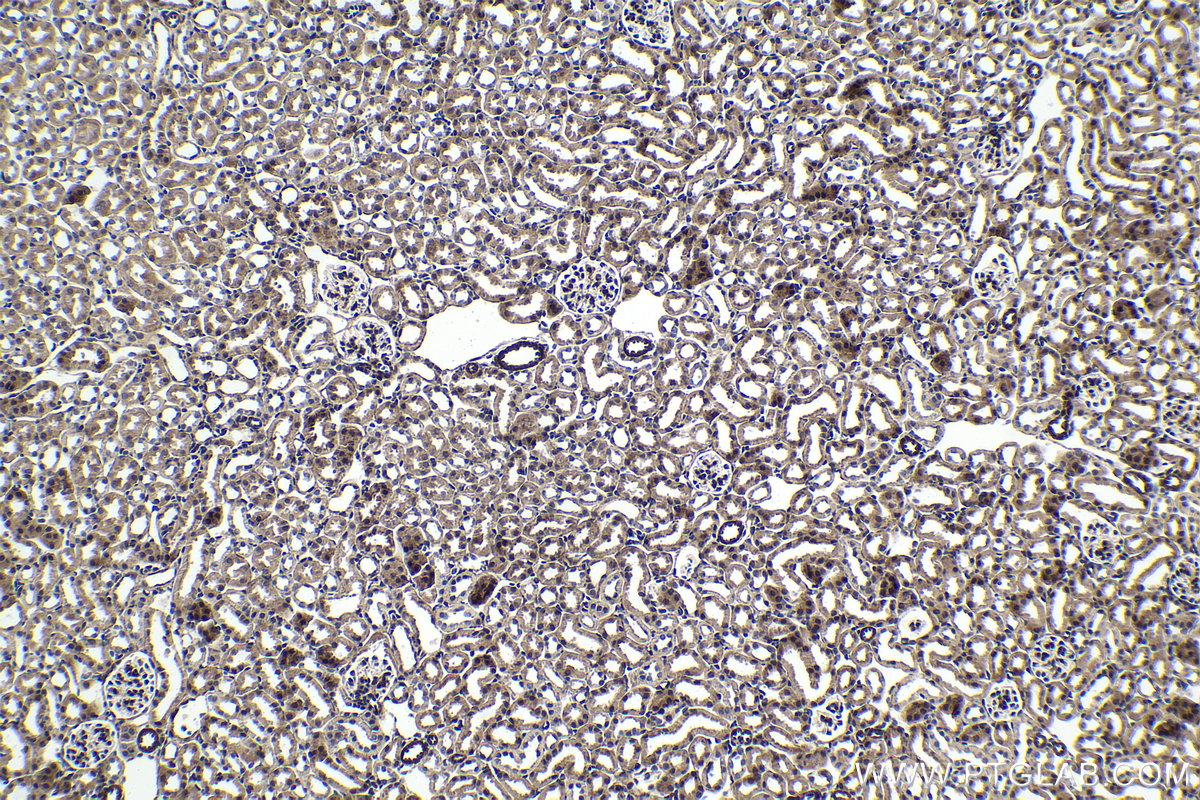 Immunohistochemical analysis of paraffin-embedded mouse kidney tissue slide using KHC1686 (PPID IHC Kit).