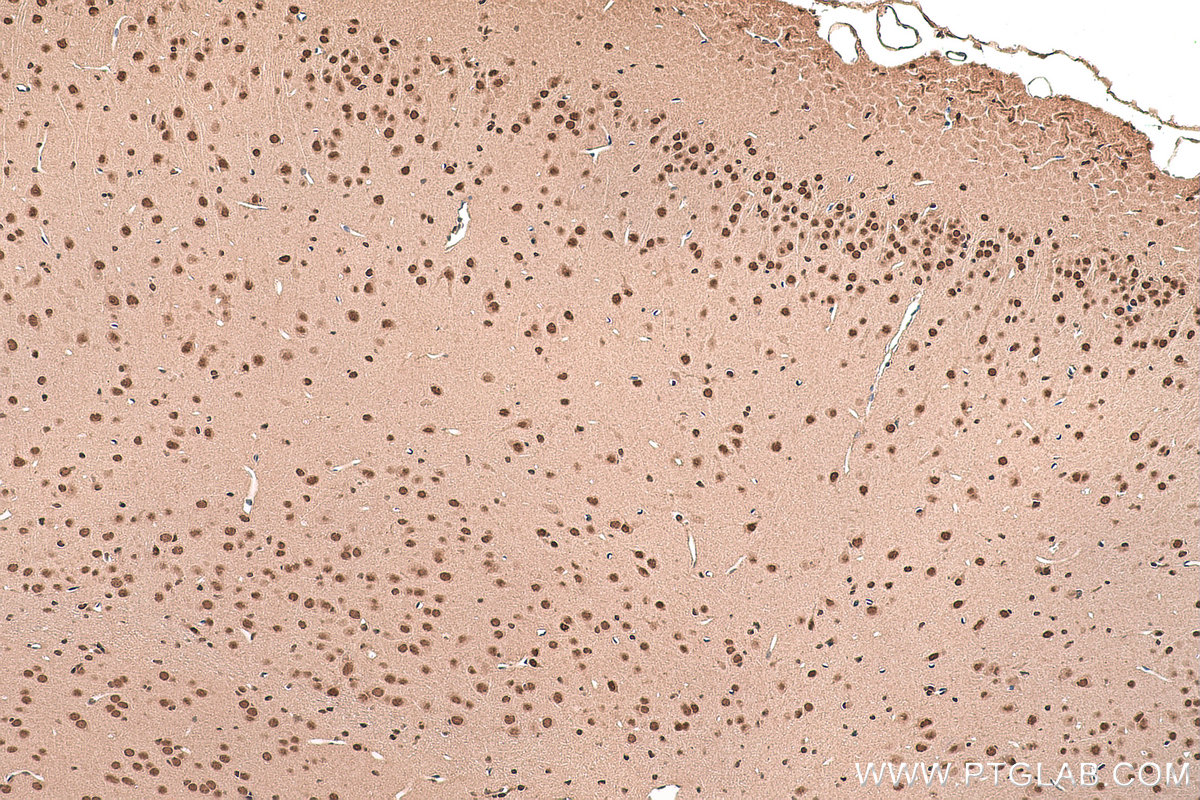 Immunohistochemical analysis of paraffin-embedded mouse brain tissue slide using KHC0837 (PPIL3 IHC Kit).