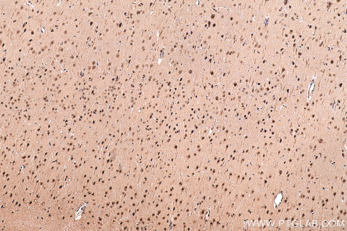 Immunohistochemical analysis of paraffin-embedded rat brain tissue slide using KHC0837 (PPIL3 IHC Kit).