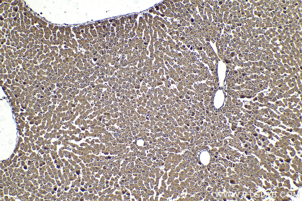 Immunohistochemical analysis of paraffin-embedded rat liver tissue slide using KHC2070 (PPM1D IHC Kit).