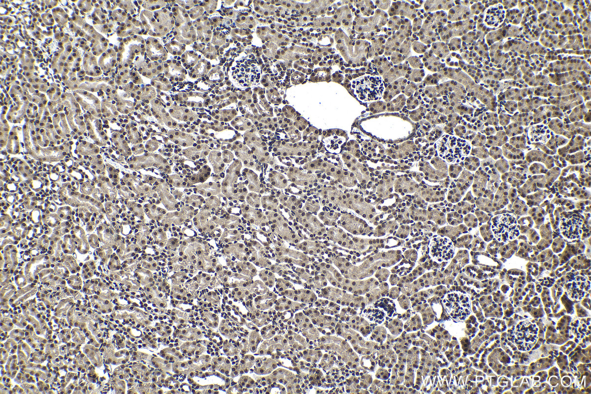 Immunohistochemical analysis of paraffin-embedded mouse kidney tissue slide using KHC1302 (PPM1G IHC Kit).