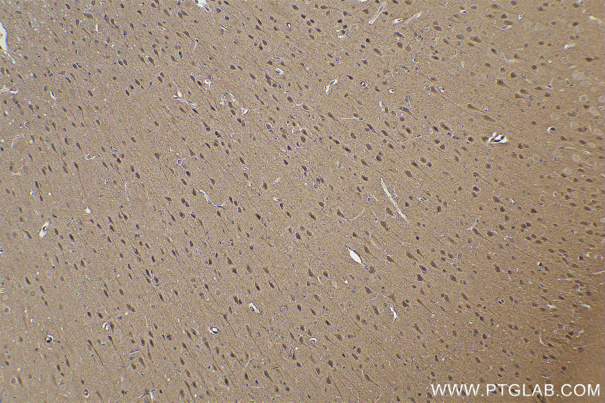 Immunohistochemical analysis of paraffin-embedded rat brain tissue slide using KHC0850 (PPP1CB IHC Kit).