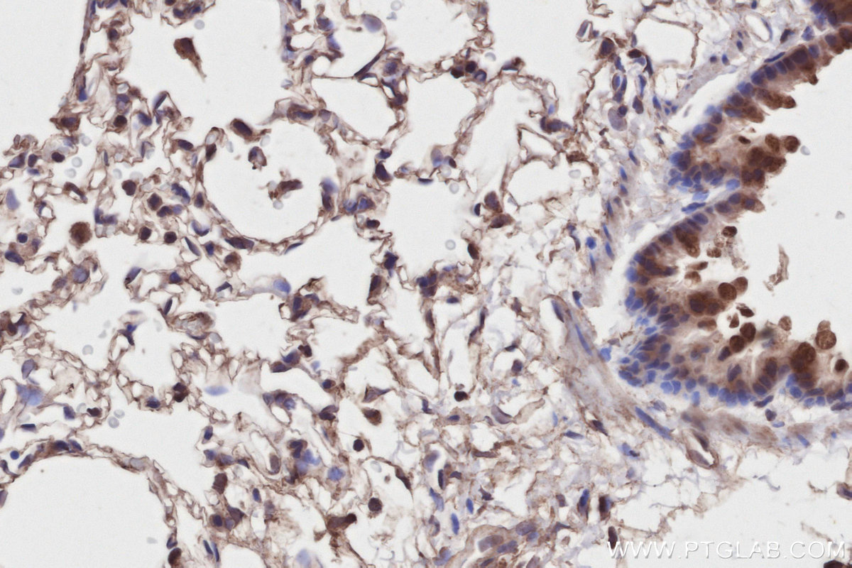 Immunohistochemical analysis of paraffin-embedded rat lung tissue slide using KHC2805 (PPP1R13B IHC Kit).