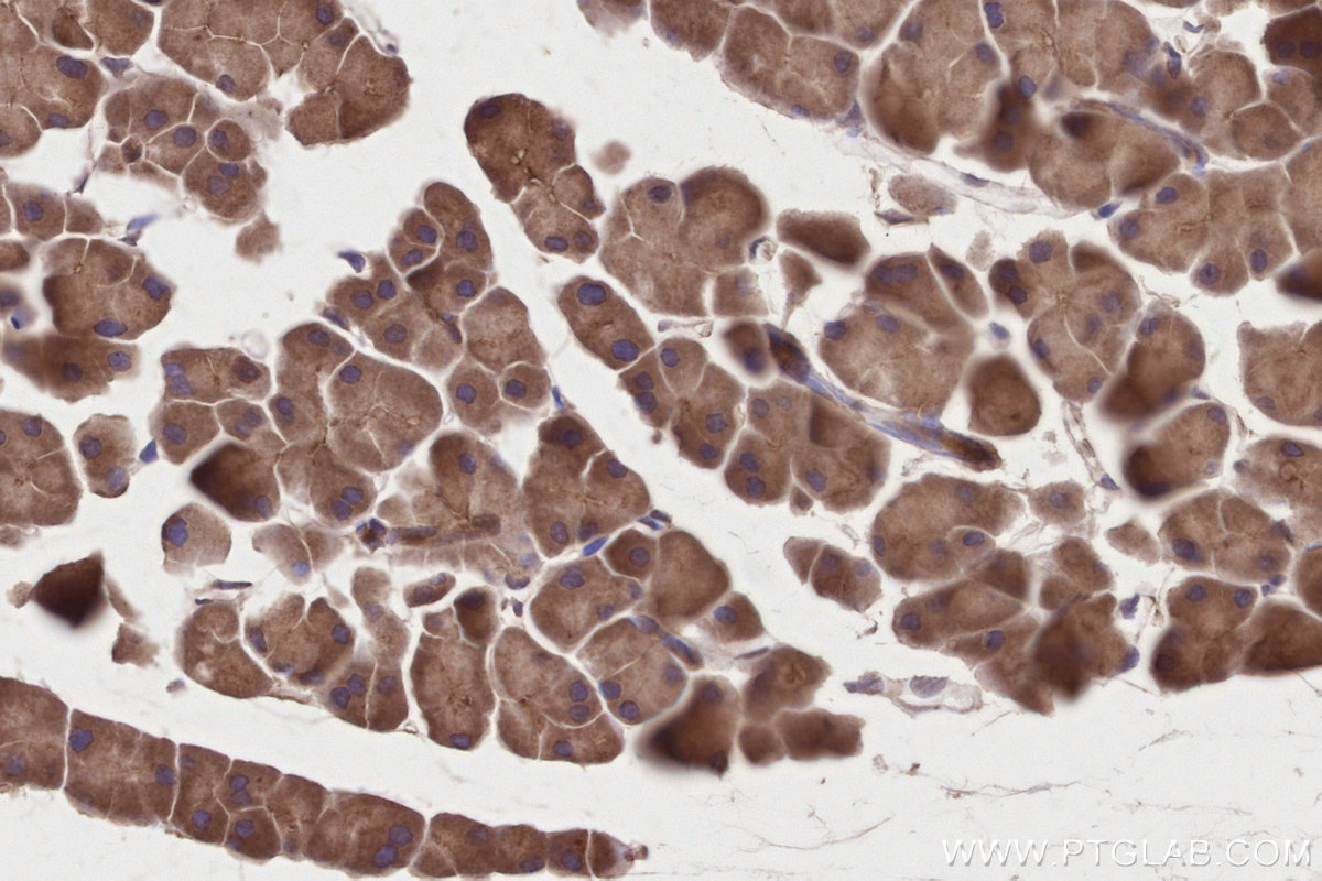 Immunohistochemical analysis of paraffin-embedded mouse pancreas tissue slide using KHC2805 (PPP1R13B IHC Kit).