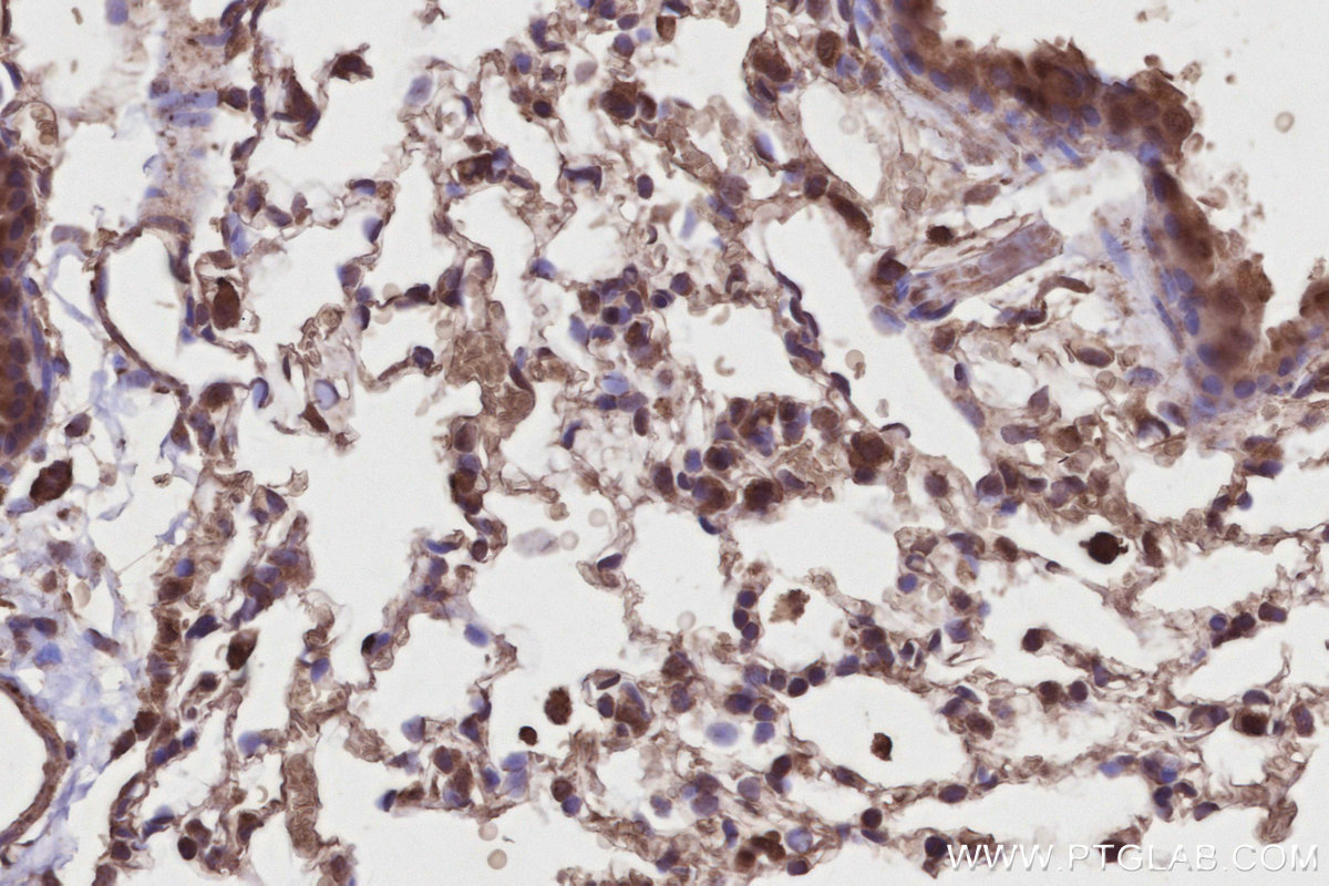 Immunohistochemical analysis of paraffin-embedded mouse lung tissue slide using KHC2805 (PPP1R13B IHC Kit).