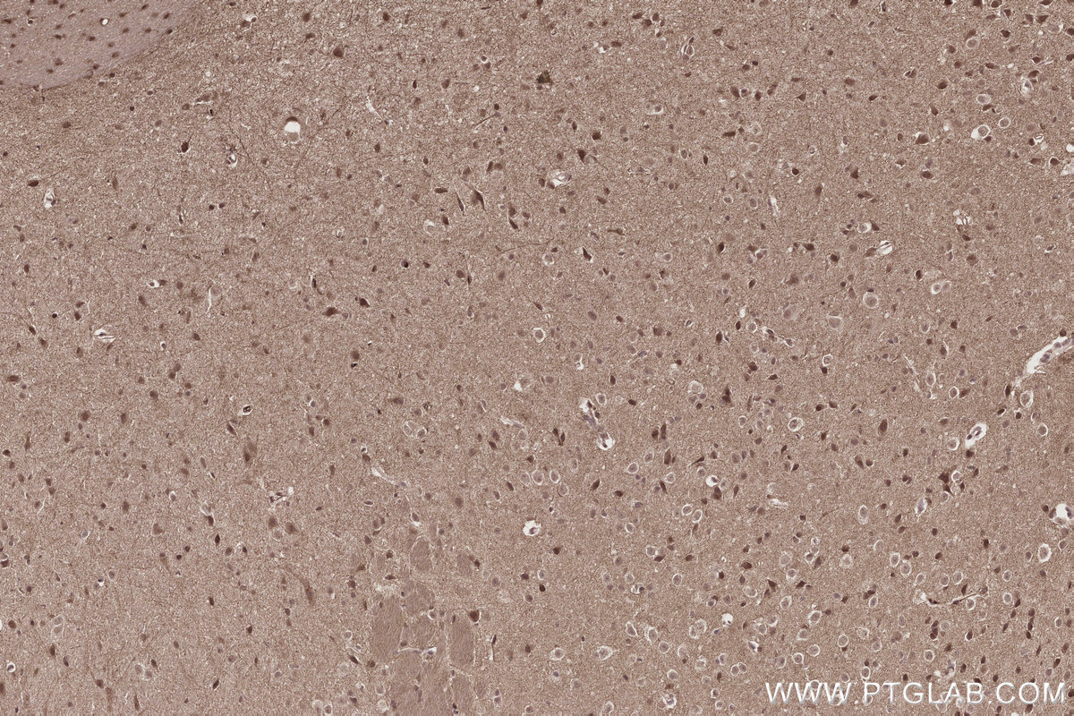 Immunohistochemical analysis of paraffin-embedded mouse brain tissue slide using KHC2805 (PPP1R13B IHC Kit).