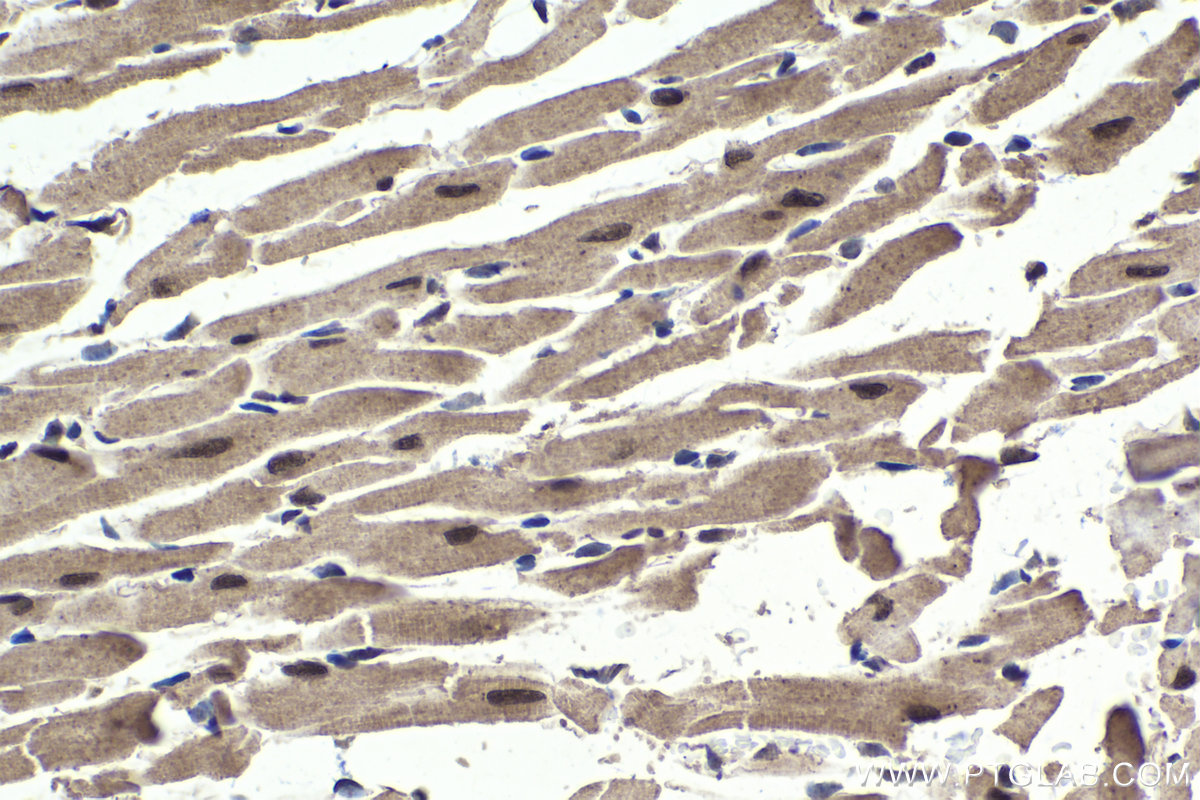 Immunohistochemical analysis of paraffin-embedded mouse heart tissue slide using KHC1697 (PPP1R8 IHC Kit).