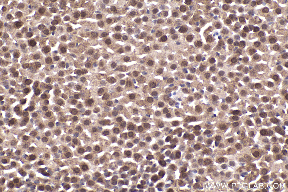 Immunohistochemical analysis of paraffin-embedded mouse adrenal gland tissue slide using KHC2226 (PPP2R1A IHC Kit).