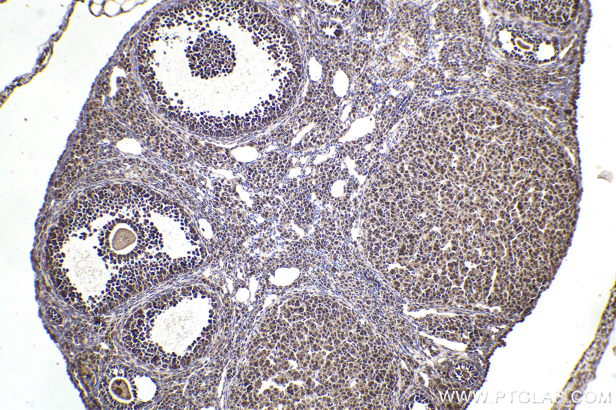 Immunohistochemical analysis of paraffin-embedded mouse ovary tissue slide using KHC2226 (PPP2R1A IHC Kit).