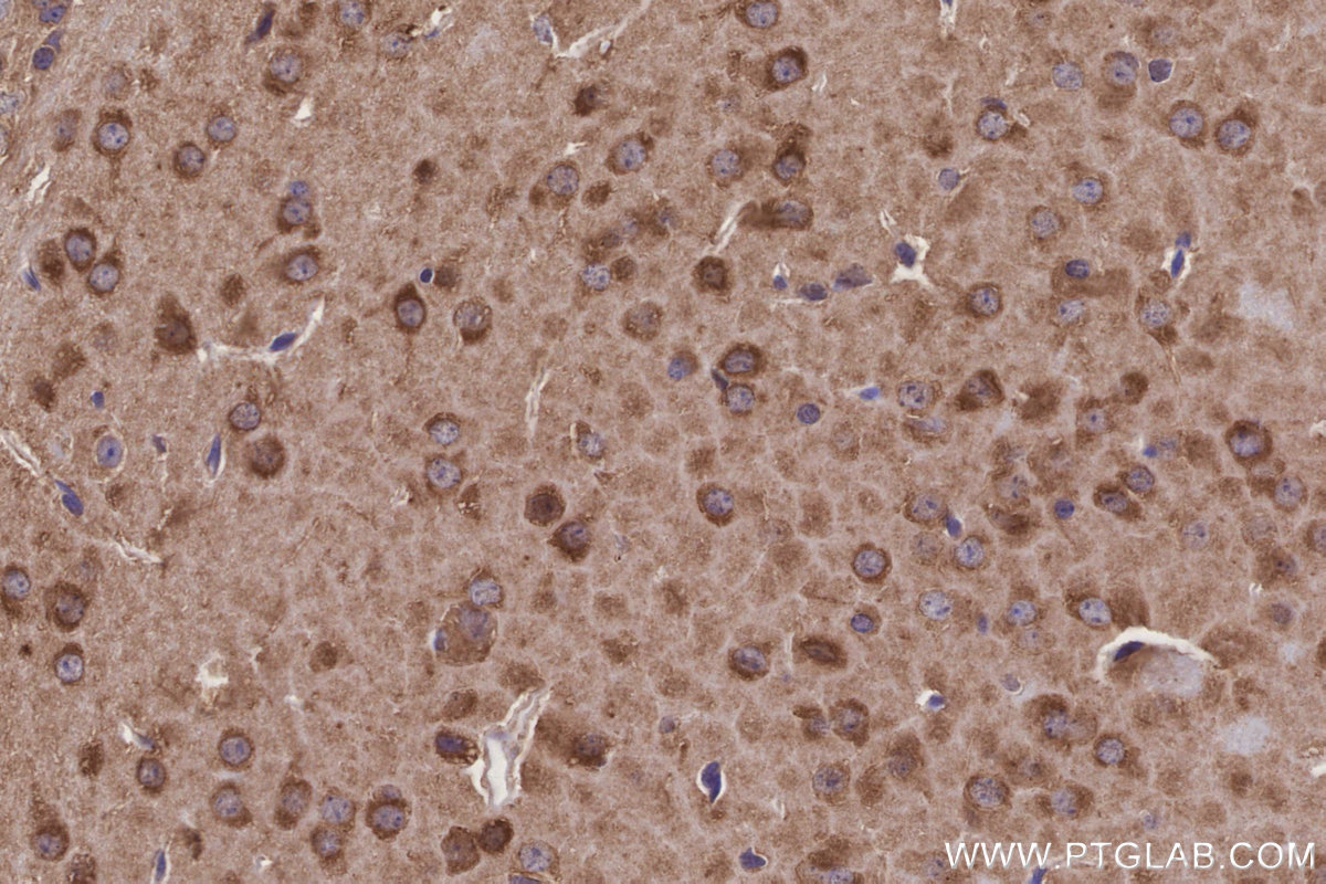 Immunohistochemical analysis of paraffin-embedded mouse brain tissue slide using KHC3246 (PPP2R2B IHC Kit).