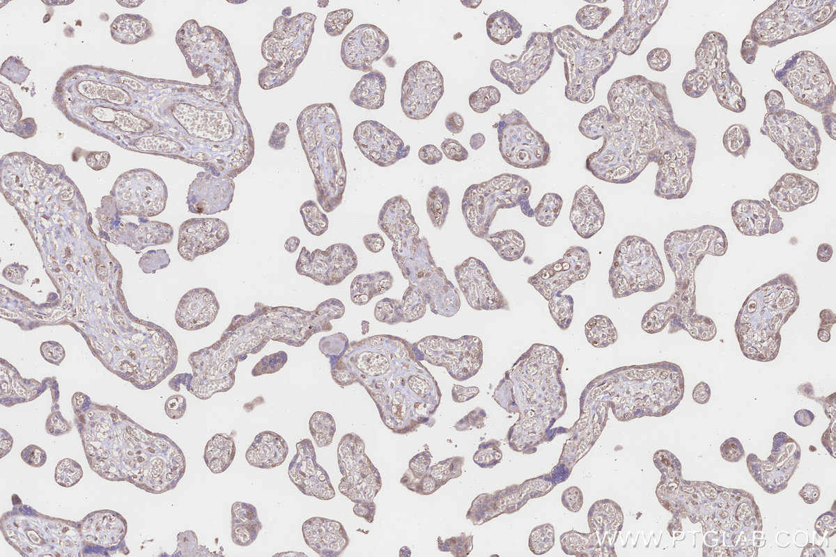 Immunohistochemical analysis of paraffin-embedded human placenta tissue slide using KHC3246 (PPP2R2B IHC Kit).