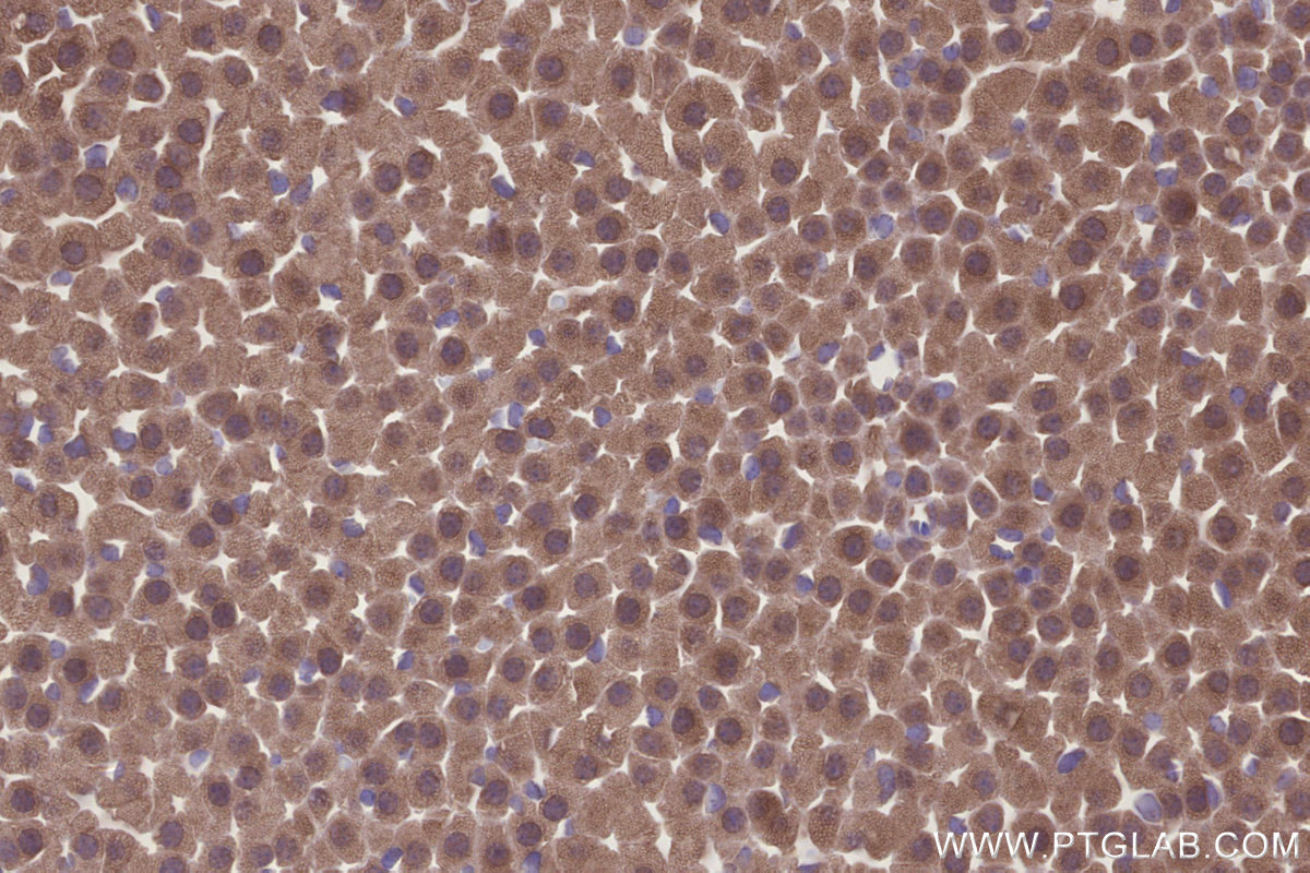 Immunohistochemical analysis of paraffin-embedded mouse adrenal gland tissue slide using KHC3246 (PPP2R2B IHC Kit).