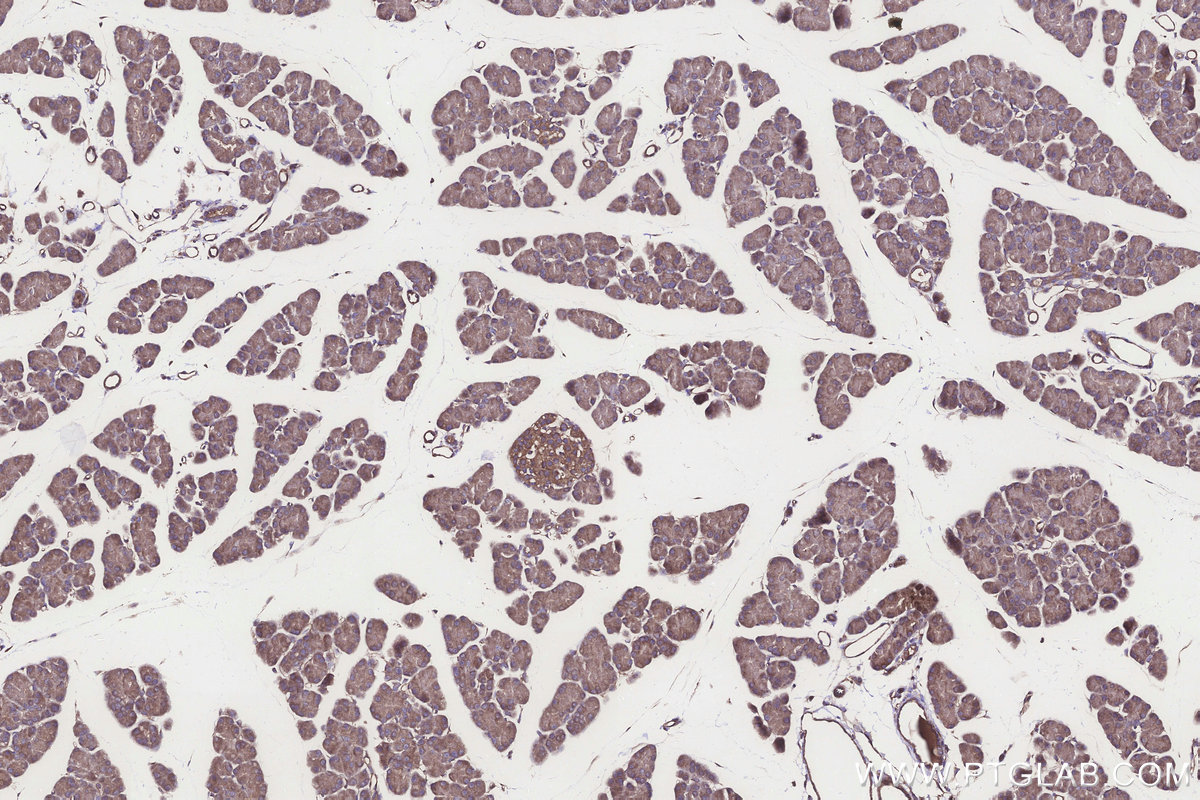Immunohistochemical analysis of paraffin-embedded rat pancreas tissue slide using KHC3246 (PPP2R2B IHC Kit).