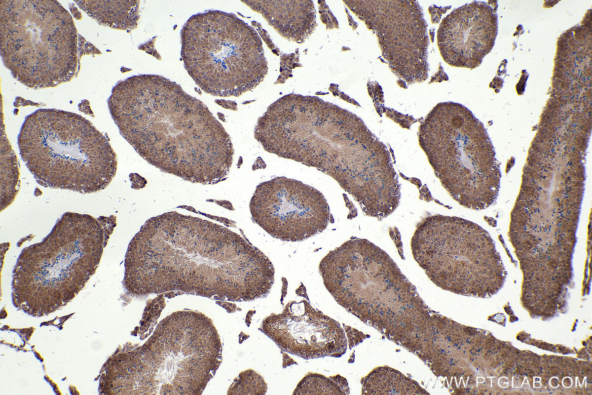Immunohistochemical analysis of paraffin-embedded mouse testis tissue slide using KHC2425 (PPP2R5C IHC Kit).