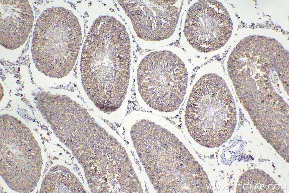 Immunohistochemical analysis of paraffin-embedded rat testis tissue slide using KHC2425 (PPP2R5C IHC Kit).