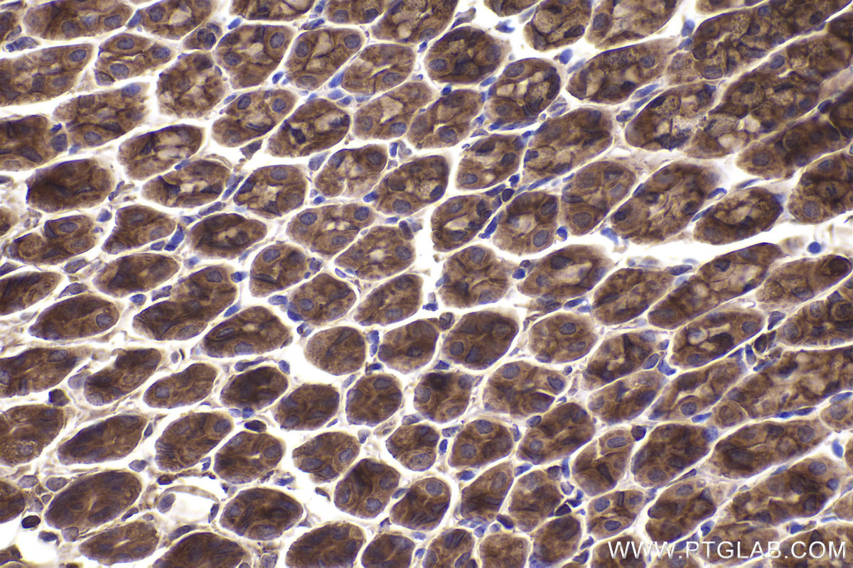 Immunohistochemical analysis of paraffin-embedded mouse stomach tissue slide using KHC2358 (PPP3R1 IHC Kit).