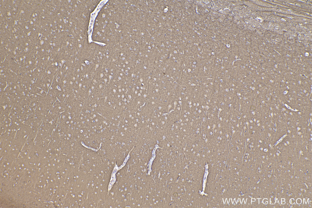 Immunohistochemical analysis of paraffin-embedded rat brain tissue slide using KHC2358 (PPP3R1 IHC Kit).
