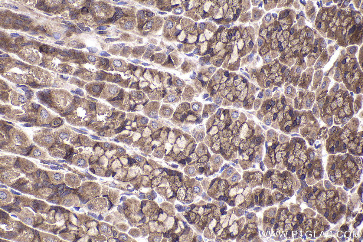 Immunohistochemical analysis of paraffin-embedded rat stomach tissue slide using KHC2358 (PPP3R1 IHC Kit).