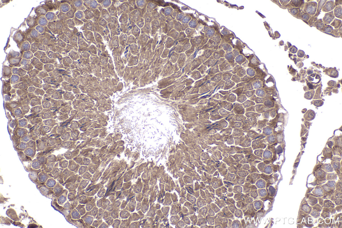 Immunohistochemical analysis of paraffin-embedded rat testis tissue slide using KHC2358 (PPP3R1 IHC Kit).