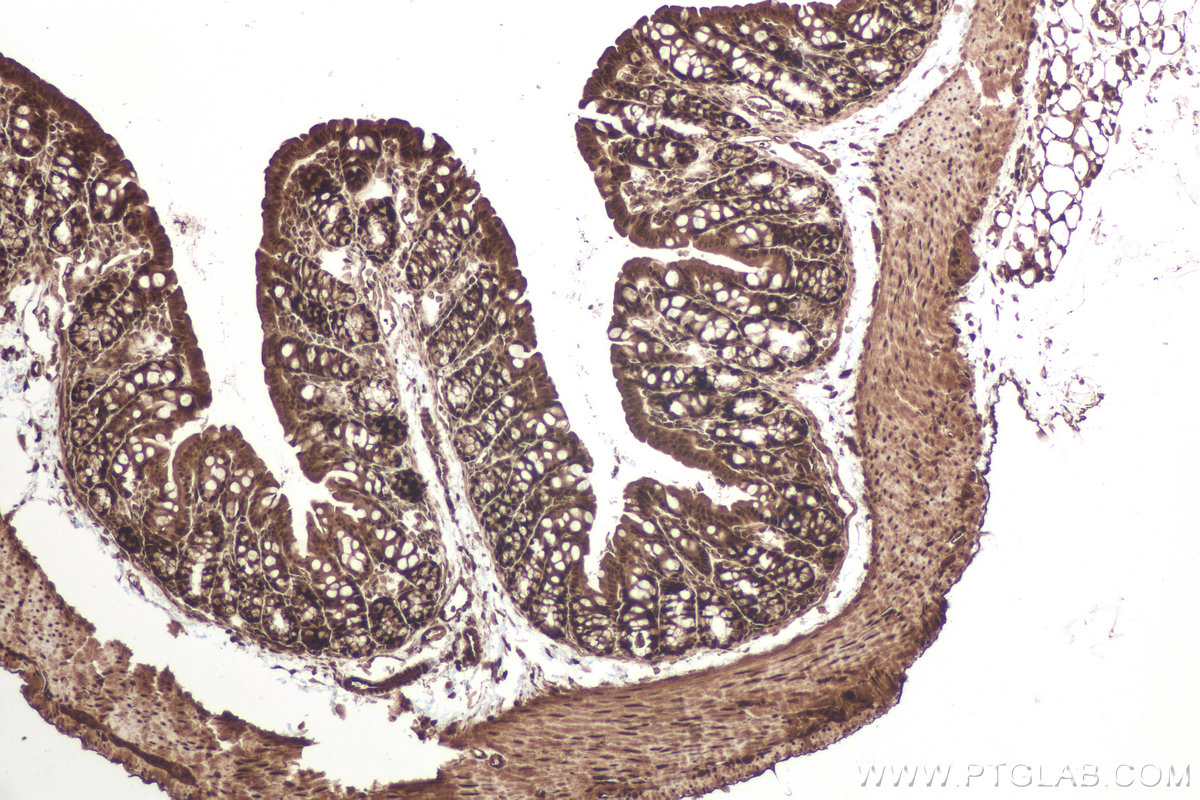 Immunohistochemical analysis of paraffin-embedded mouse colon tissue slide using KHC1002 (PPP4C IHC Kit).