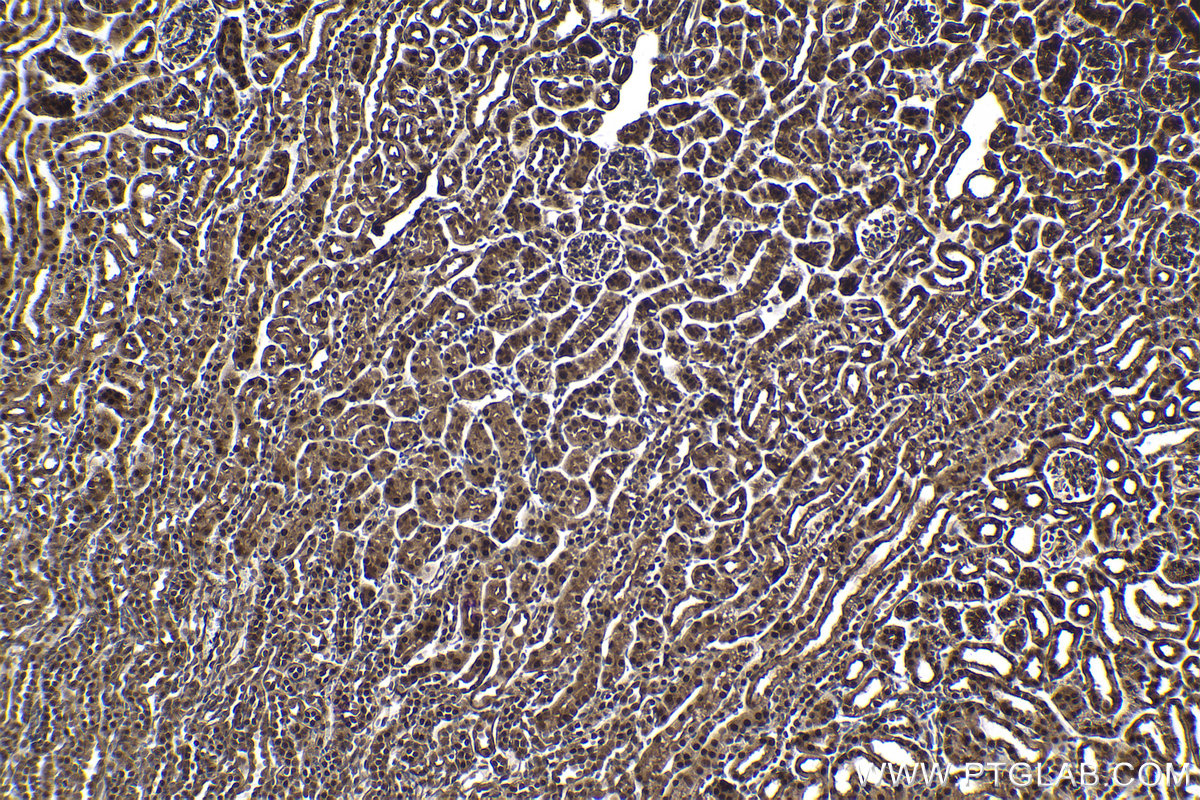 Immunohistochemical analysis of paraffin-embedded mouse kidney tissue slide using KHC1002 (PPP4C IHC Kit).