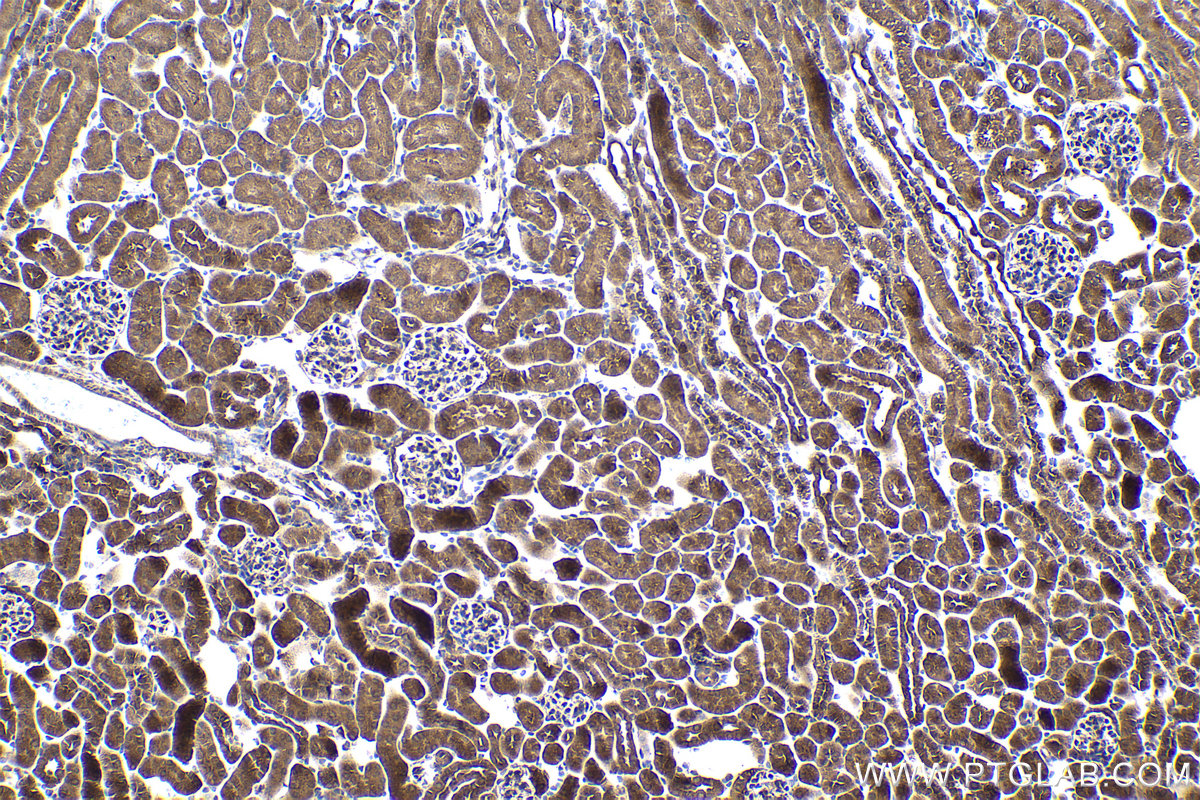 Immunohistochemical analysis of paraffin-embedded mouse kidney tissue slide using KHC1013 (PPP6C IHC Kit).