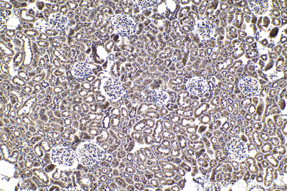 Immunohistochemical analysis of paraffin-embedded rat kidney tissue slide using KHC1013 (PPP6C IHC Kit).