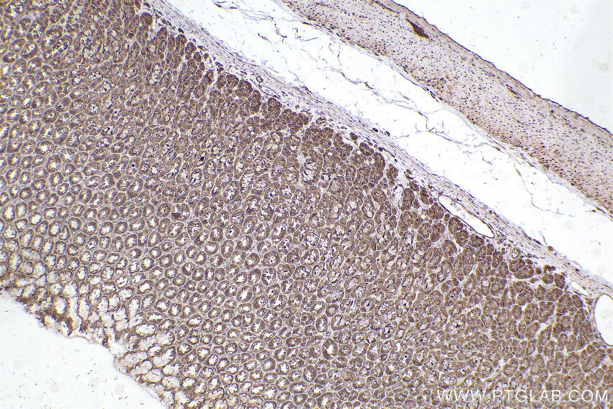 Immunohistochemical analysis of paraffin-embedded rat stomach tissue slide using KHC2543 (PPP6R3/SAPS3 IHC Kit).