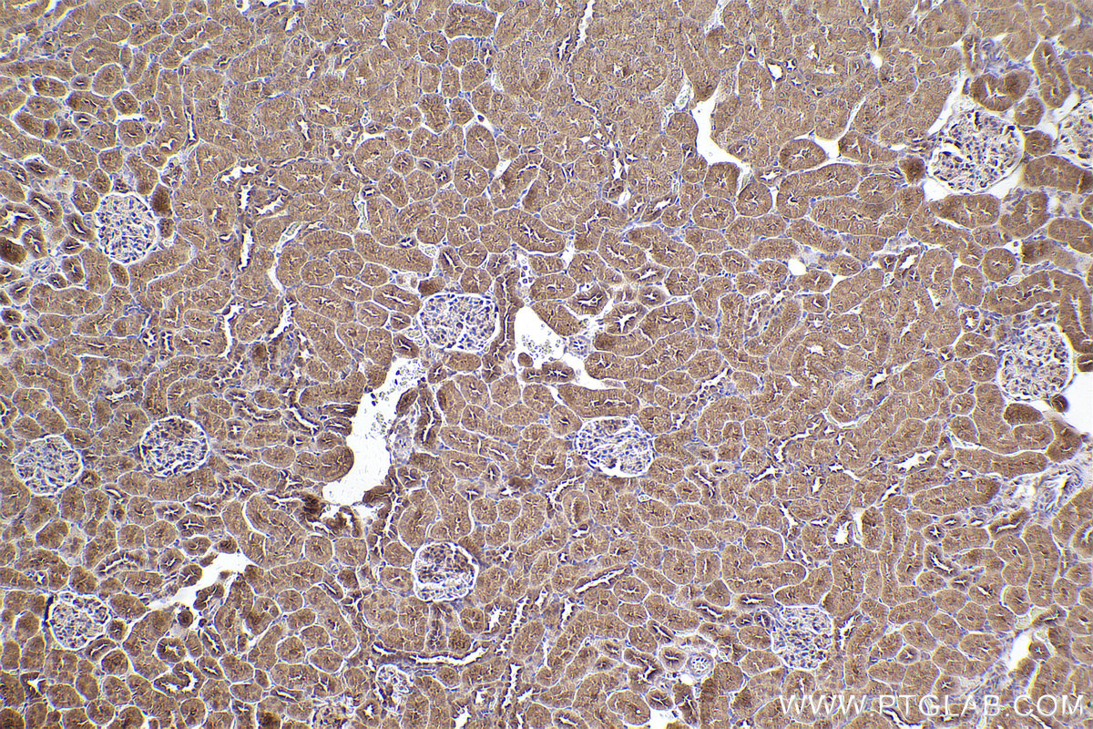 Immunohistochemical analysis of paraffin-embedded rat kidney tissue slide using KHC2543 (PPP6R3/SAPS3 IHC Kit).
