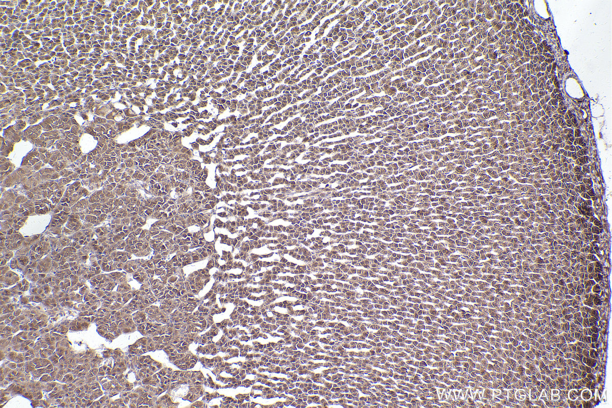 Immunohistochemical analysis of paraffin-embedded rat adrenal gland tissue slide using KHC2543 (PPP6R3/SAPS3 IHC Kit).