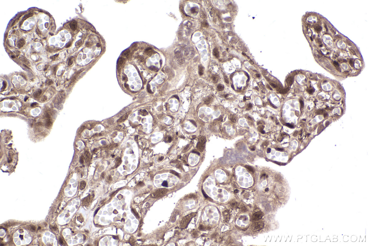 Immunohistochemical analysis of paraffin-embedded human placenta tissue slide using KHC2543 (PPP6R3/SAPS3 IHC Kit).