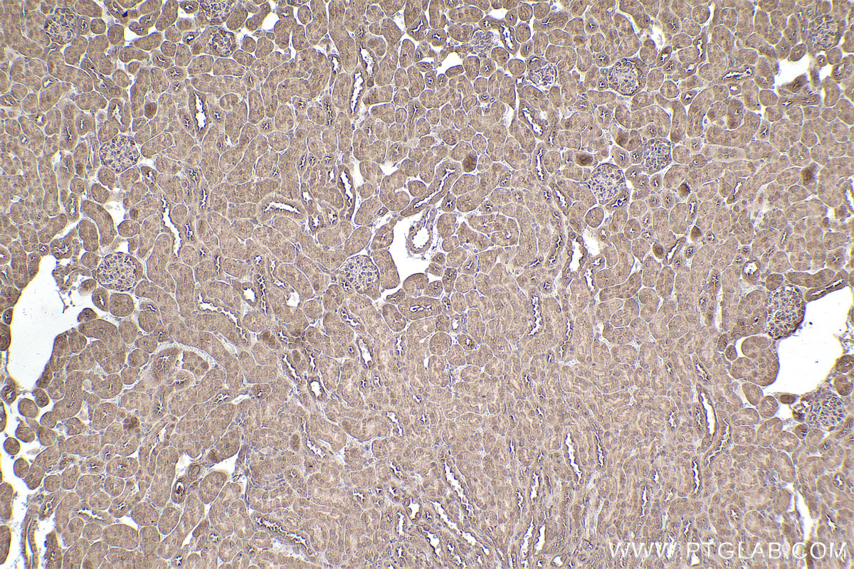 Immunohistochemical analysis of paraffin-embedded mouse kidney tissue slide using KHC2543 (PPP6R3/SAPS3 IHC Kit).