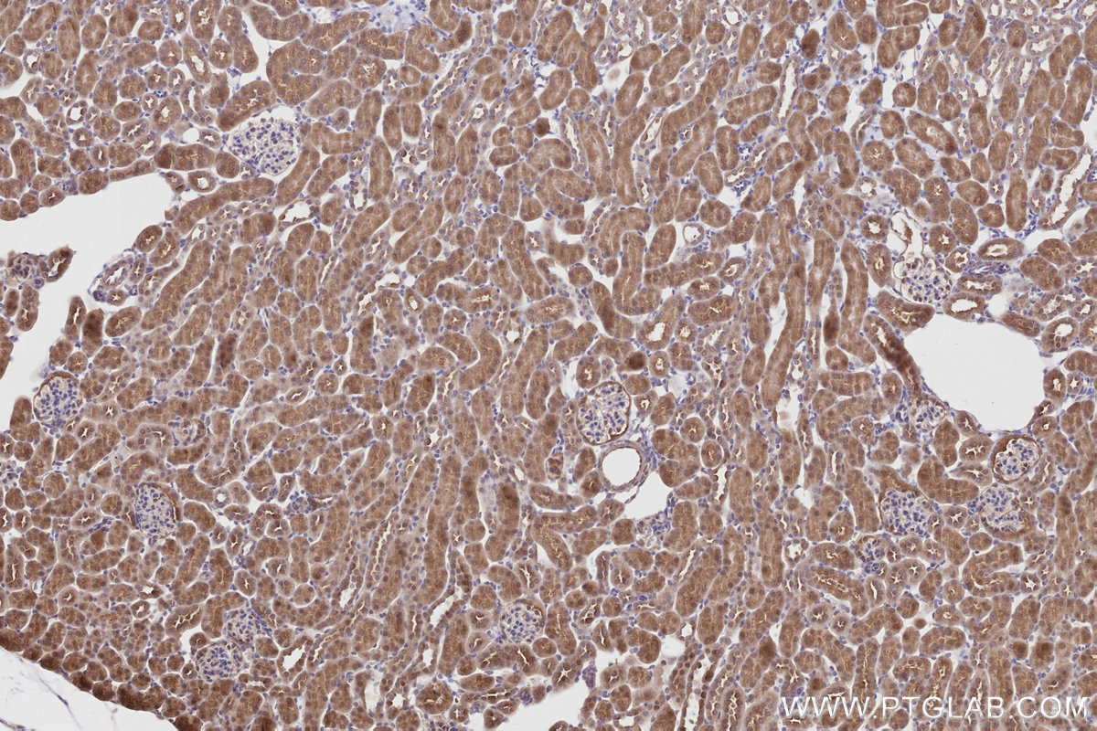 Immunohistochemical analysis of paraffin-embedded mouse kidney tissue slide using KHC2811 (PRAP1 IHC Kit).